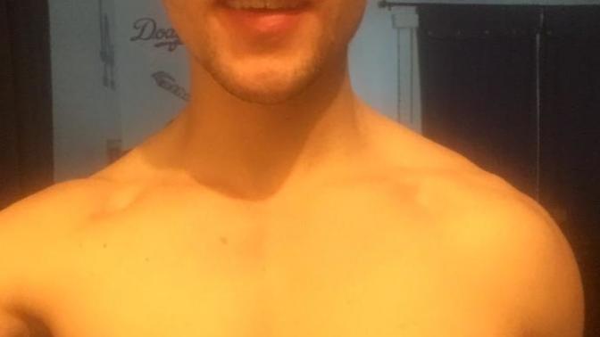 Do you have any birthmarks, & do you find them attractive?