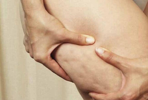 Is it a complete turn off if a girl has cellulite?