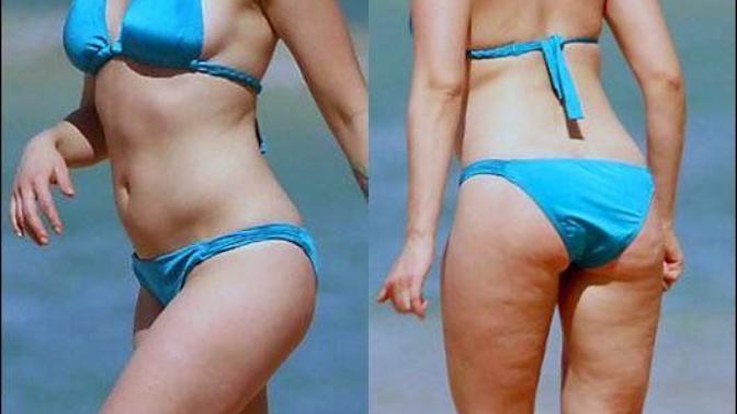 Is it a complete turn off if a girl has cellulite?