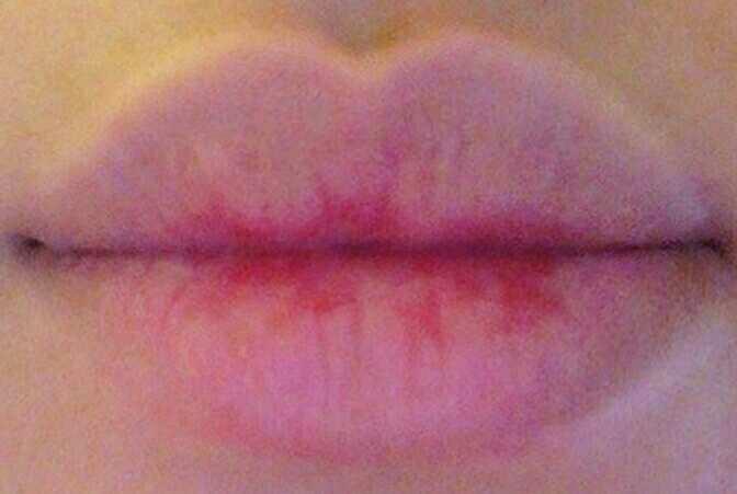 Drop a pic of your lips or rate my lips??