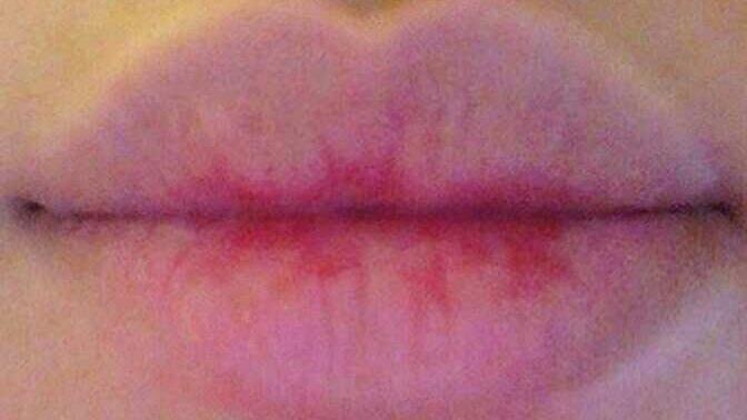 Drop a pic of your lips or rate my lips?