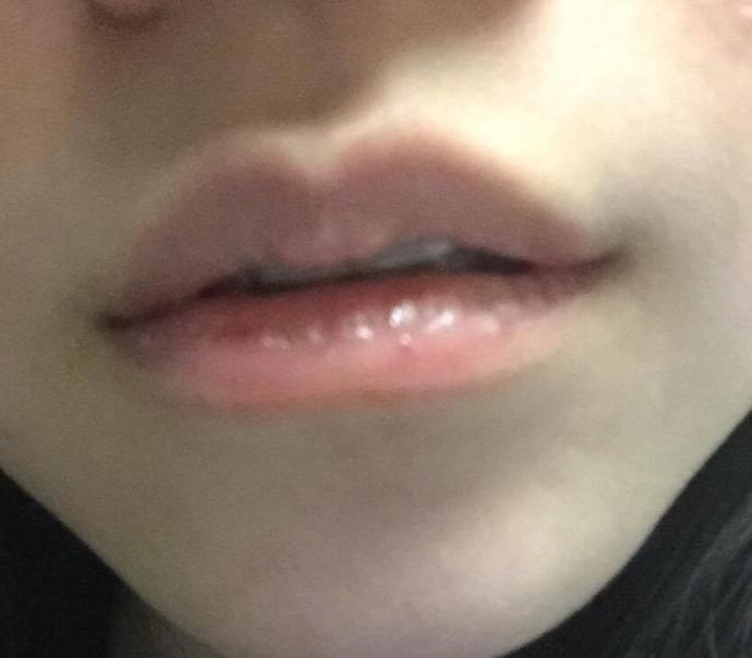 Does my lip look kissable?