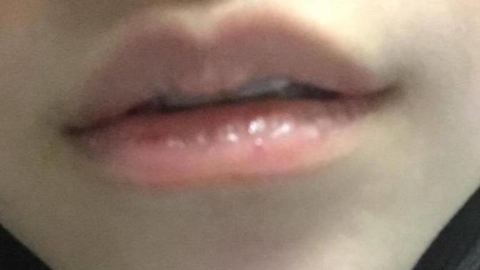 Does my lip look kissable?