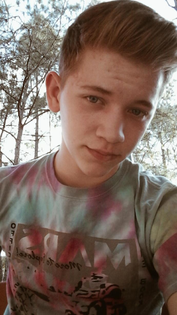 Girls, I'm just wondering, how would you rate my looks? I'm told I'm attractive but I don't really think I am because of acne scars. Thoughts?