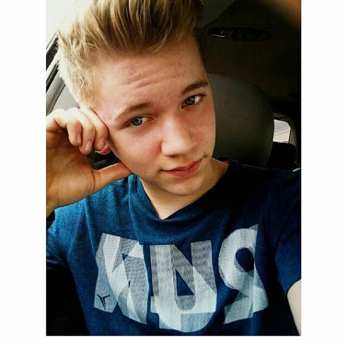 Girls, I'm just wondering, how would you rate my looks? I'm told I'm attractive but I don't really think I am because of acne scars. Thoughts?