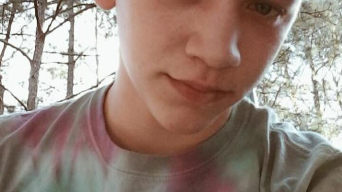 Girls, I'm just wondering, how would you rate my looks? I'm told I'm attractive but I don't really think I am because of acne scars. Thoughts?