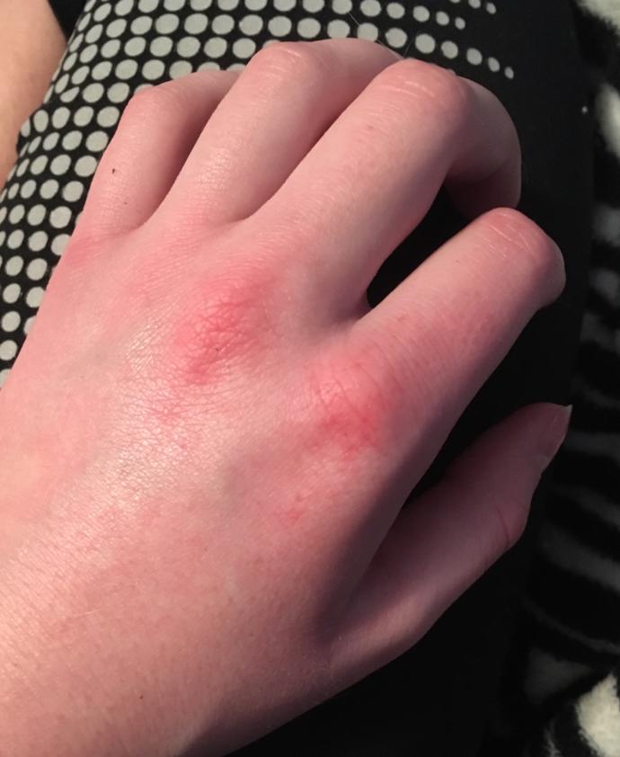 Y'all, is this normal?