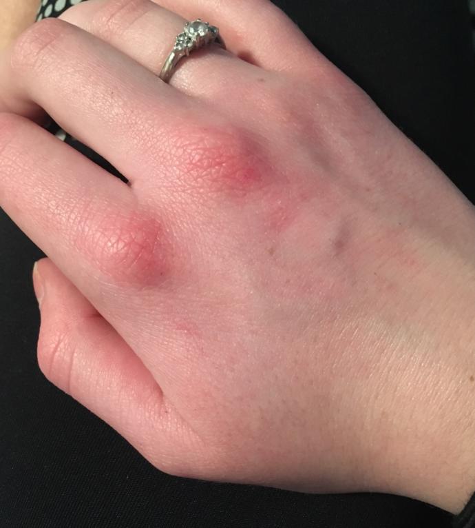 Y'all, is this normal?