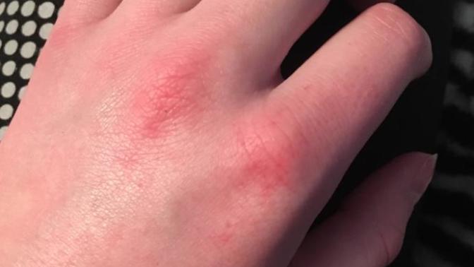 Y'all, is this normal?