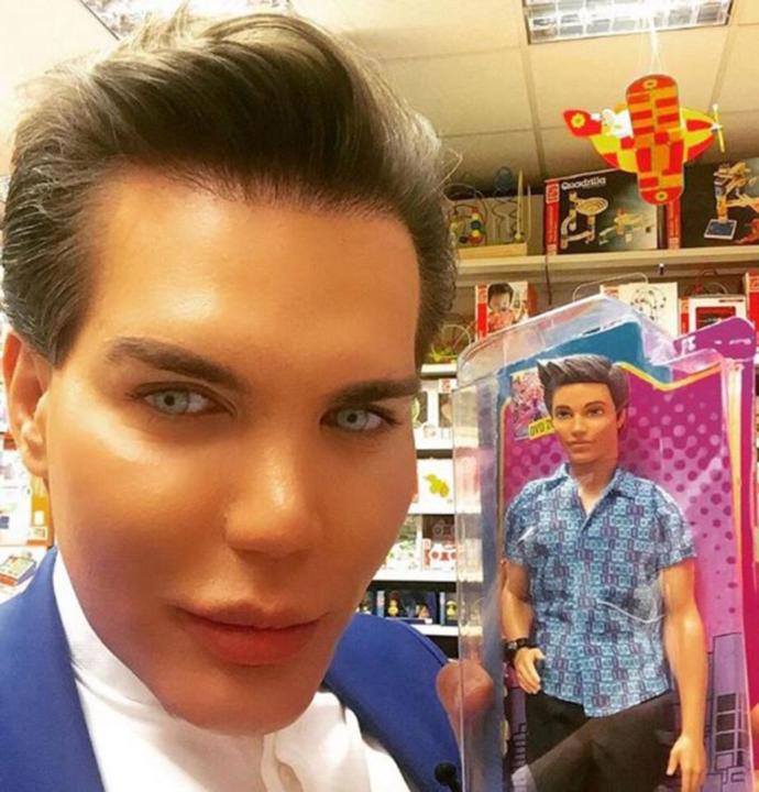 Real- life Ken and Barbie: What's your opinion on plastic surgery obsession?