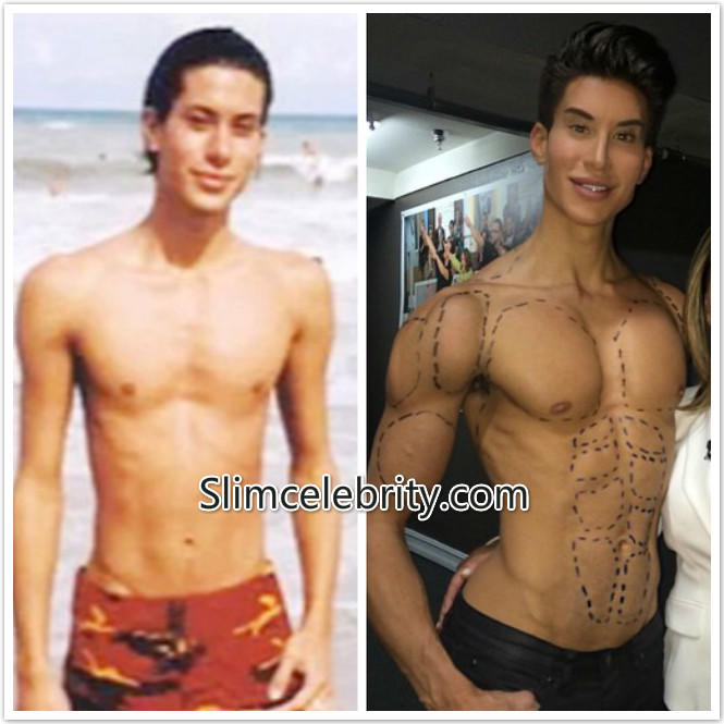 Real- life Ken and Barbie: What's your opinion on plastic surgery obsession?