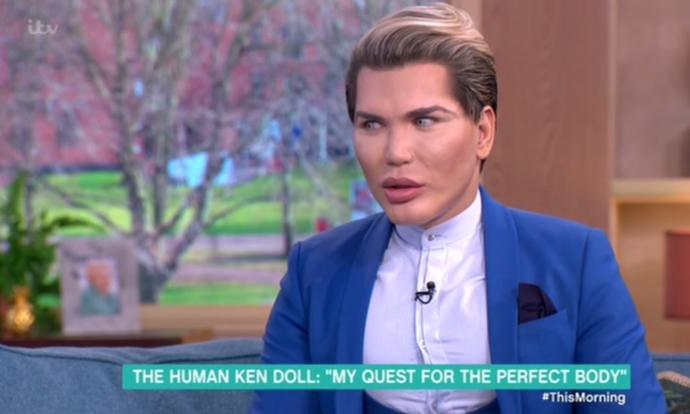 Real- life Ken and Barbie: What's your opinion on plastic surgery obsession?