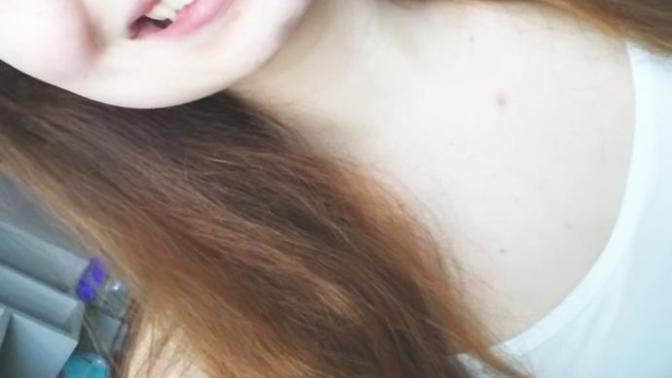 Is my smile/teeth unnatractive (Pictures)?