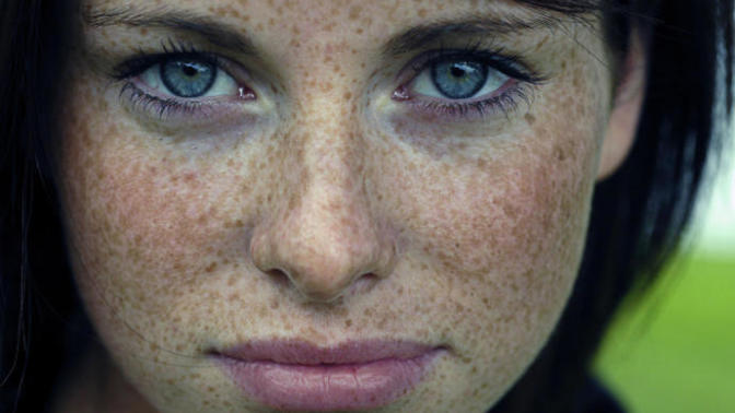 Do you find freckles on women/men attractive or disgusting?