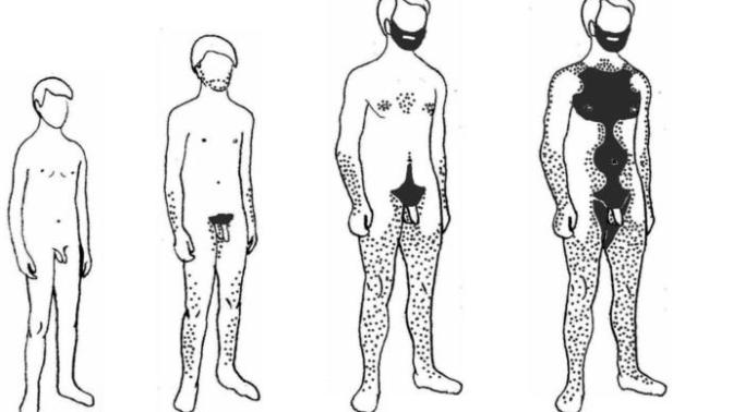 Girls, Which of these types of men would be appealing to women in general and you in particular?