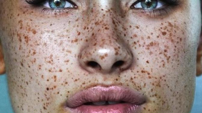 Do guys like girls with freckles?