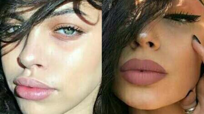Can you spot fake lips?