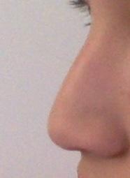 Is my nose ugly?