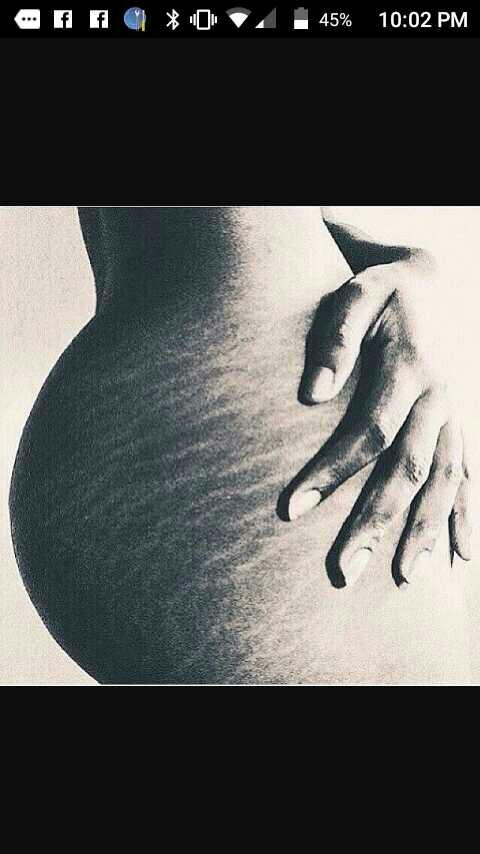 What Is Your Opinion On Stretch Marks??