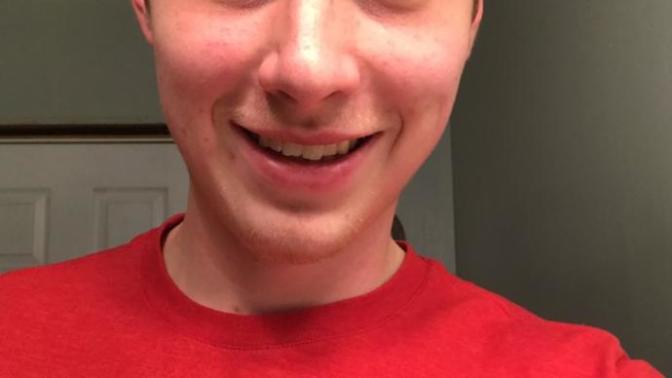 So lately I've been thinking of why I haven't been getting any girls that I approach and figured maybe it's my smile. Is my smile ugly? Be honest?