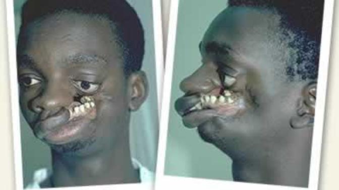 Would you be friends with someone who has a severe facial deformity?
