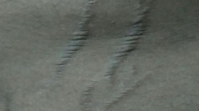 Are these stretch marks too much? Would you still date me?
