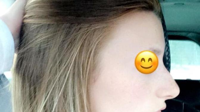 Is my nose as big and ugly as I think it is?