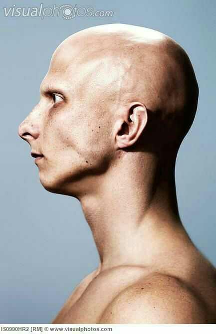 Is there a face shape treatment? for face like this??