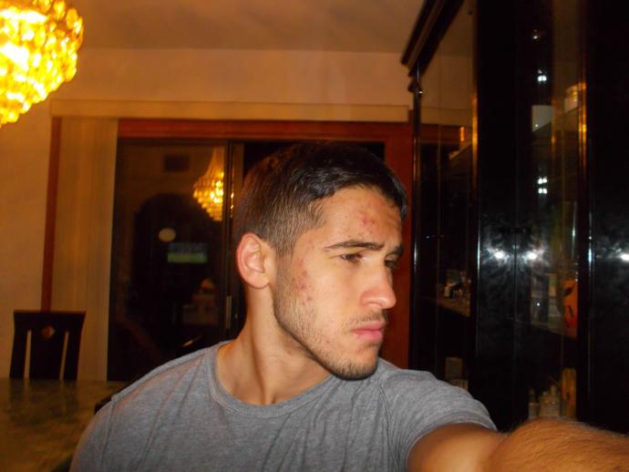 Have you ever found at least one guy/girl with acne, that was surprisingly attractive?