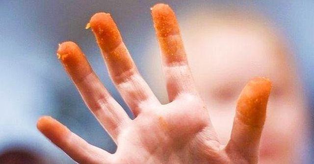 Would you rather have cheeto dust on your fingers for the rest of your life or a popcorn kernel stuck in your throat for the rest of your life?