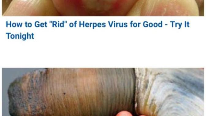 Does gag really have to advertise like this?