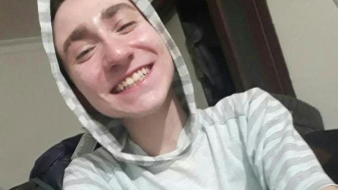 Do I need braces?