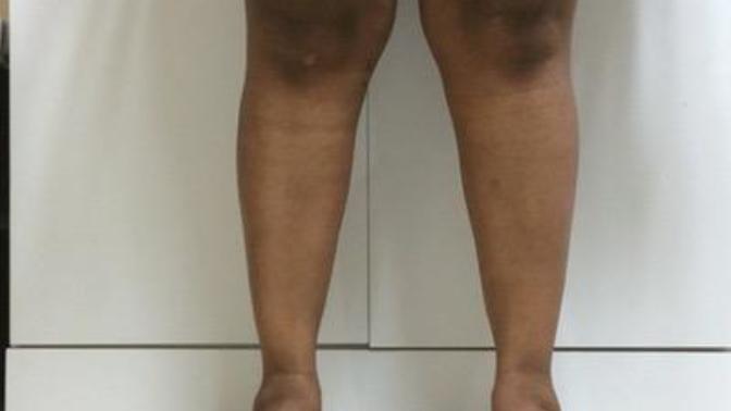 Do you think this is a major transformation?