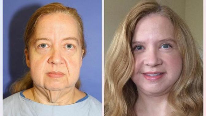 How old did she look before and how old does she look now?
