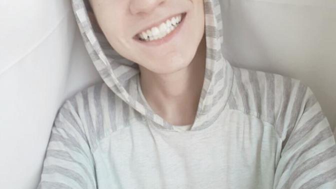 Do my teeth look bad?