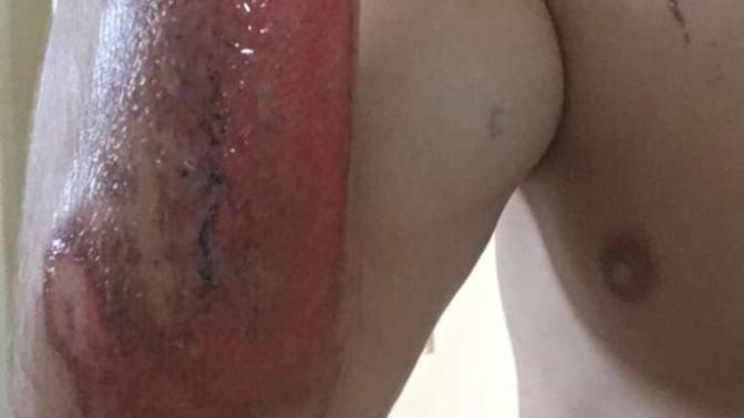 How many scars do you have?