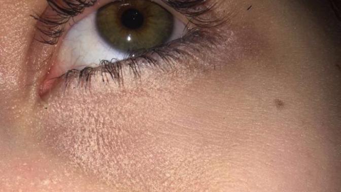 Why is my under eye concealer doing this?