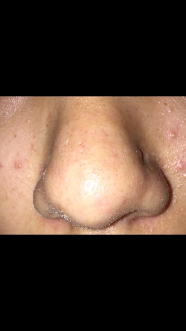 How to make these holes smaller?