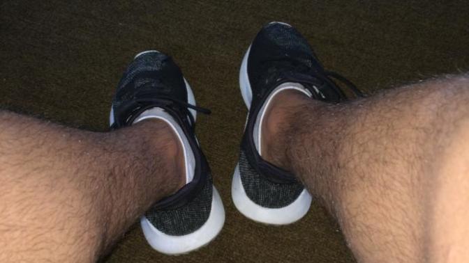 Girls, Are my legs too hairy?