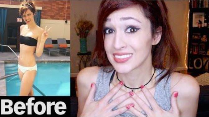 What part of your body are you most insecure about?