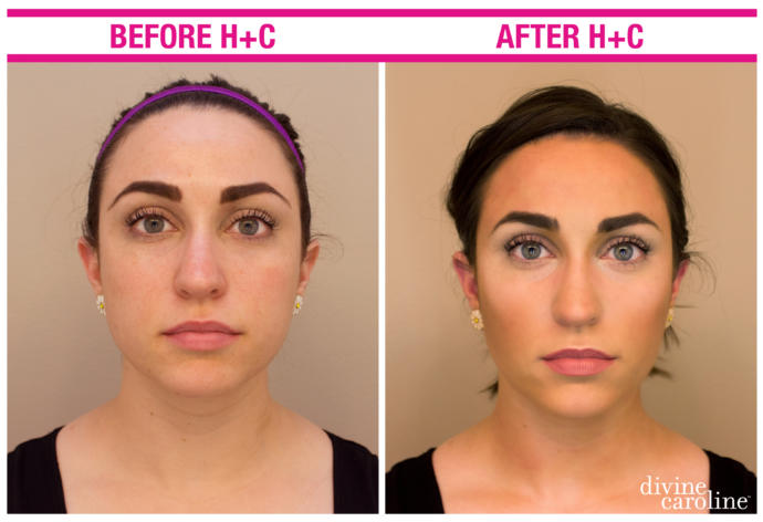 I like pie face girls. I like the before pic ): Am I weird?
