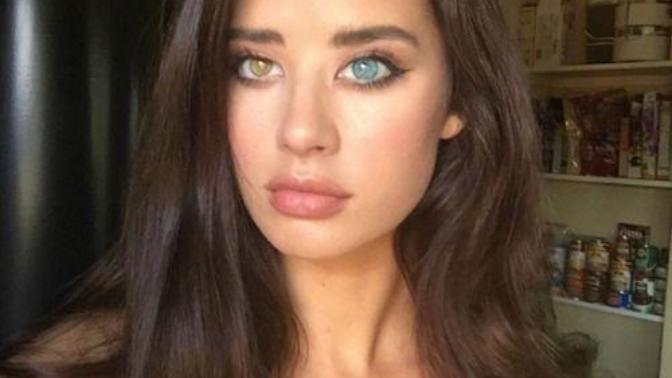 Do you find heterochromia attractive?