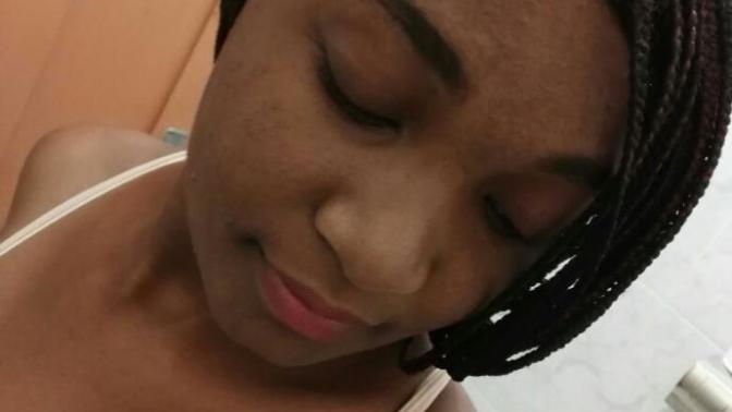 Do you mind if a girl has acne?