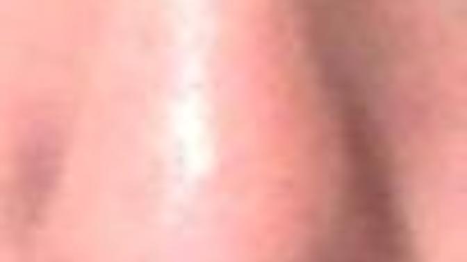 Why is my nose like this?