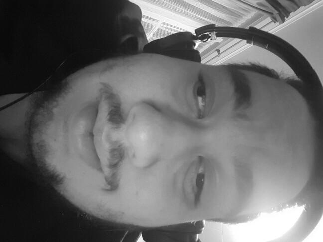 Ladies does my Lazy eye bother you??