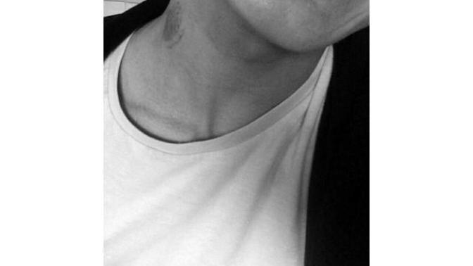 What do you think about braces?