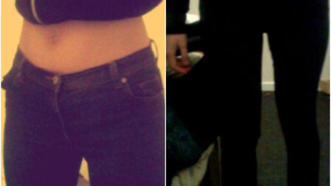 Am I Anorexic or just skinny?