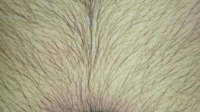 Trouble with hairs over stomach?