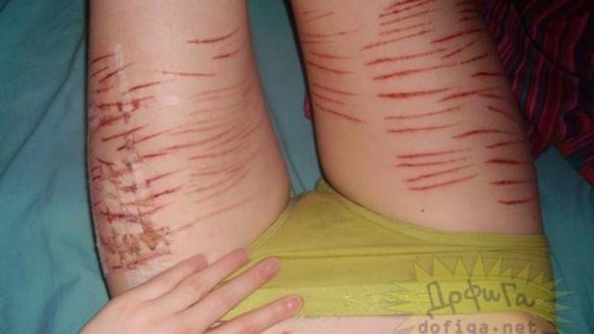 Will he be disturbed by my scars? Will he stop loving me?