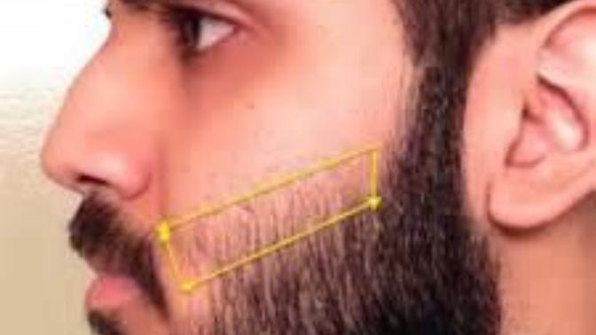 Can a weak chin be attracrive?